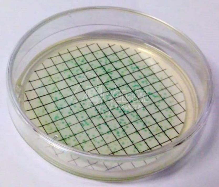 controle_de_nivel_microbiologico_04